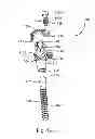 Fig. 40 - System and Method for Bone Anchorage