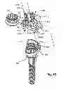 Fig. 43 - System and Method for Bone Anchorage