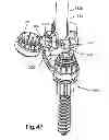 Fig. 44 - System and Method for Bone Anchorage