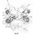 Fig. 45 - System and Method for Bone Anchorage