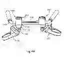 Fig. 46 - System and Method for Bone Anchorage