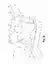 Fig. 08 - Dynamic fixation device and method of use