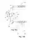 Fig. 16 - Dynamic fixation device and method of use