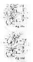 Fig. 19 - Dynamic fixation device and method of use
