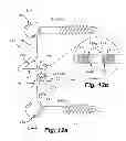 Fig. 20 - Dynamic fixation device and method of use