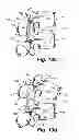 Fig. 23 - Dynamic fixation device and method of use