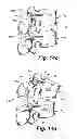 Fig. 25 - Dynamic fixation device and method of use