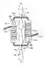 Fig. 01 - DEVICE AND ACCESSORIES FOR LIMITING FLEXION