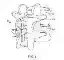 Fig. 04 - DEVICE AND ACCESSORIES FOR LIMITING FLEXION