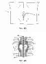 Fig. 06 - DEVICE AND ACCESSORIES FOR LIMITING FLEXION