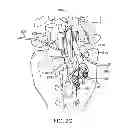 Fig. 22 - DEVICE AND ACCESSORIES FOR LIMITING FLEXION