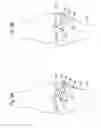 Fig. 06 - Methods and systems for planning and performing an osteotomy