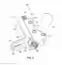 Fig. 04 - IMPLANT FOR OSTEOTOMY, TOOL FOR INSERTING THE IMPLANT, AND METHOD OF INSERTING THE IMPLANT USING THE TOOL