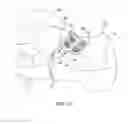 Fig. 12 - IMPLANT FOR OSTEOTOMY, TOOL FOR INSERTING THE IMPLANT, AND METHOD OF INSERTING THE IMPLANT USING THE TOOL