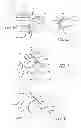 Fig. 06 - MODULAR AND NON-MODULAR CORTICAL BUTTRESS DEVICE