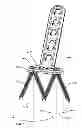 Fig. 01 - Highly-versatile variable-angle bone plate system