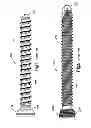 Fig. 02 - Highly-versatile variable-angle bone plate system