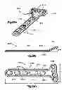 Fig. 32 - Highly-versatile variable-angle bone plate system