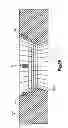 Fig. 37 - Highly-versatile variable-angle bone plate system