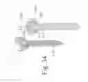 Fig. 33 - Devices and methods for dynamic fixation of skeletal structure