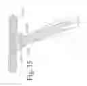 Fig. 34 - Devices and methods for dynamic fixation of skeletal structure