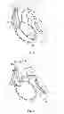 Fig. 04 - Cardiac stimulating device
