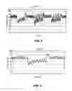 Fig. 02 - Methods and systems for lowering blood pressure through reduction of ventricle filling