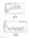 Fig. 03 - Methods and systems for lowering blood pressure through reduction of ventricle filling