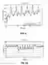 Fig. 04 - Methods and systems for lowering blood pressure through reduction of ventricle filling