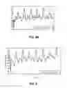 Fig. 05 - Methods and systems for lowering blood pressure through reduction of ventricle filling
