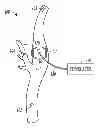 Fig. 01 - Stimulation patch with passive adhesion