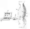 Fig. 01 - Symmetrical output neurostimulation device