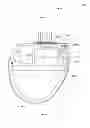 Fig. 01 - Pre-loaded vibration isolator for implantable device