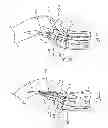 Fig. 05 - Expandable stent-graft system having diameter reducing connectors