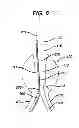 Fig. 07 - Cannulation guiding device for bifurcated stent and method of use