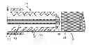 Fig. 01 - Stent deployment device and methods for use