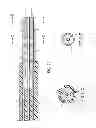 Fig. 04 - Stent deployment device and methods for use