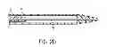 Fig. 06 - Stent deployment device and methods for use
