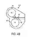 Fig. 09 - Stent deployment device and methods for use