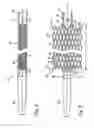 Fig. 03 - Implant having high fatigue resistance, delivery system, and method of use