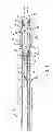 Fig. 02 - Implant delivery assembly and method of use