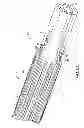 Fig. 07 - Implant delivery assembly and method of use