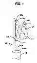 Fig. 02 - STENT CANNULATION GUIDING DEVICE AND METHOD OF USE