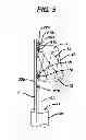 Fig. 06 - STENT CANNULATION GUIDING DEVICE AND METHOD OF USE