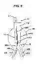 Fig. 07 - STENT CANNULATION GUIDING DEVICE AND METHOD OF USE