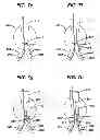 Fig. 09 - STENT CANNULATION GUIDING DEVICE AND METHOD OF USE