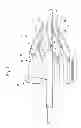 Fig. 09 - Apparatus and method for improved deployment of endovascular grafts