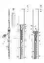 Fig. 02 - STENT DELIVERY SYSTEM