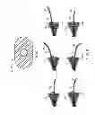 Fig. 06 - STENT DELIVERY SYSTEM