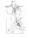 Fig. 02 - Wireless endovascular stent-based electrodes